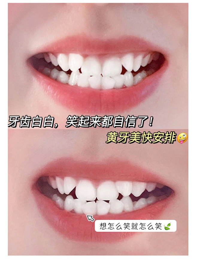 oralshark参半口腔鲨鱼牙膏益生菌...