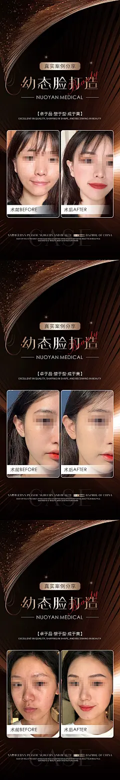 医美幼态脸宣传海报长图-志设网-zs9.com