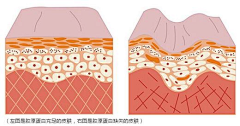 HE怡文采集到肌肤结构