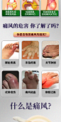 治痛风冷敷疑胶止痛膏维生素h降尿酸溶石去结晶大脚趾中药克星药-淘宝网