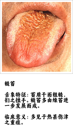 阿宅学医记采集到舌诊图