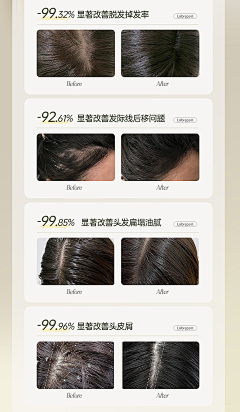 【生发女】对比图-花瓣网|陪你做生活的设计师 | esults