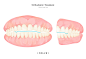 口腔模型 牙齿牙龈 咬合线 健齿插图插画设计PSD tid273t000500