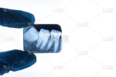 戴手套的牙医手持下弱智智齿的x光片