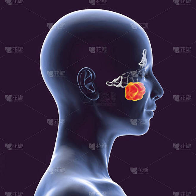 上颌窦的解剖。三维图显示女性有突出的上颌窦，也被称为海莫尔腹股沟，侧视图