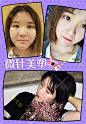 微针美塑