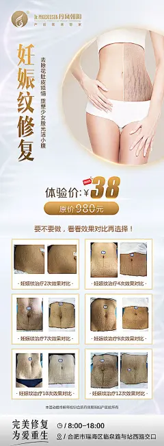 展架 易拉宝 医美 美容 整形 妊娠纹 修复 案例 宣传