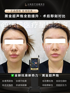 霏girl采集到案例水印