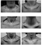 anatomy: neck references