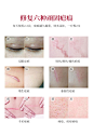 威格菲（WGFei）去疤膏 医用祛疤膏剖腹产手术烫伤疤痕宁伤疤凹凸增生疤痕修复疤痕灵 大容量25g/支【图片 价格 品牌 报价】-京东
