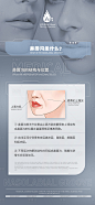 医美鼻唇沟科普海报-源文件