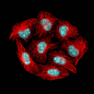 激光共聚焦显微镜下的癌细胞
Photograph cancer cells by Sergey Lekomtsev on 500px