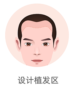小噜哩采集到植发