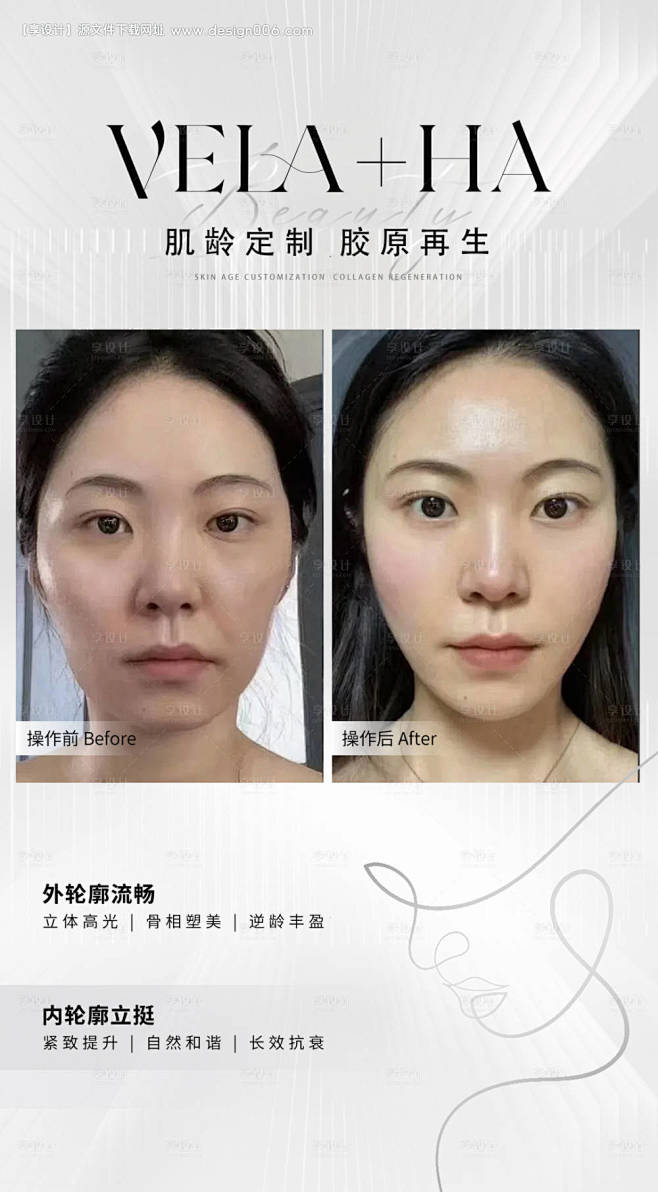 医美抗衰对比图-源文件【享设计】