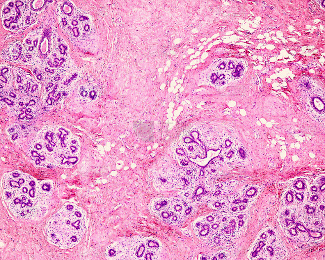 人类乳房腺。小叶