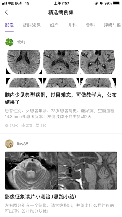 我是冯宝宝222采集到列表式设计