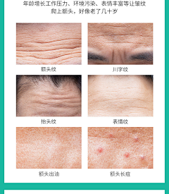 gln猴儿采集到皮肤衰老
