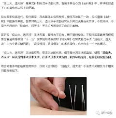 这名字可用采集到砭术、刮痧，拔罐