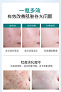 凡妍烟酰胺亮颜冻干粉寡肽原液淡化红血丝祛痘印痘坑修护敏感精华-tmall.com天猫