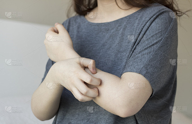 女孩抓痒与手，手臂，痒，概念与保健和医学。