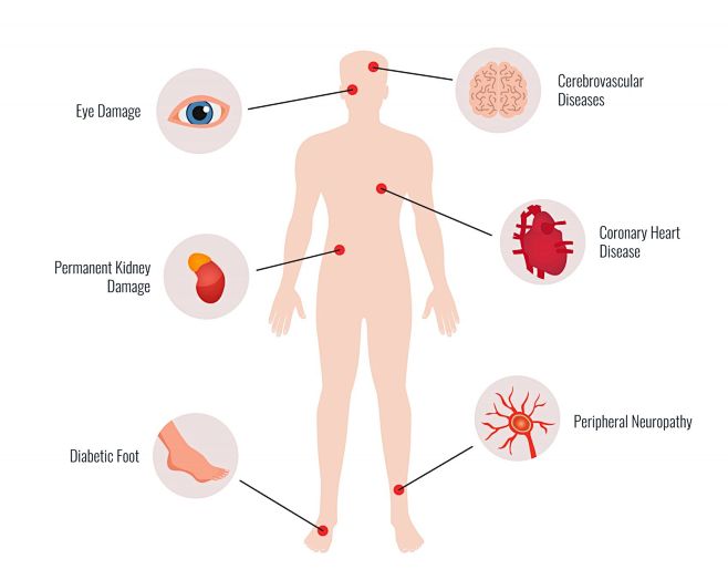 糖尿病并发症医学教育人体器官图封面大图