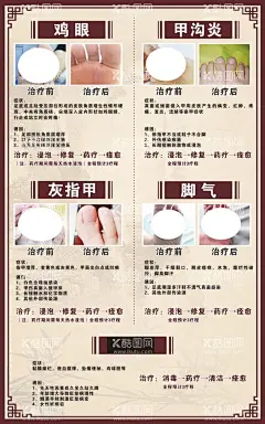 足疗  - 源文件下载【酷图网】足疗,足道,足浴,足底按摩,修脚,足浴店海报,足浴广告,足疗广告,足疗海报,足疗店挂画,足疗店文化,中医养生,足疗养生,按摩,按脚,足疗传单,足疗单页,足疗彩页,传统足疗,足疗按摩,足疗保健,沐足,足浴养生,中医足疗,中医按摩,足疗店,足疗价目表,足疗店价目表,养生,足疗挂画,足疗素材,脚对比图,