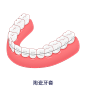 牙套正畸牙齿矫正材料种类-陶瓷牙套