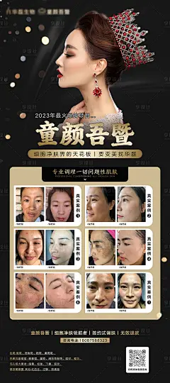 轻医美祛斑祛痘美白亮肤活动海报展架-源文件