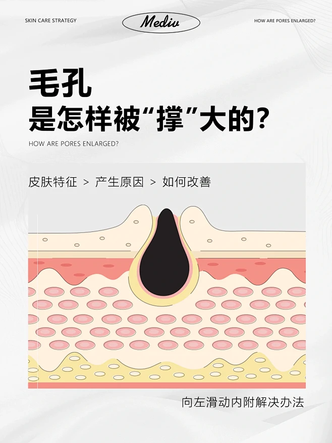 护肤知识|毛孔是怎样被撑大的 如何收缩️-花瓣网