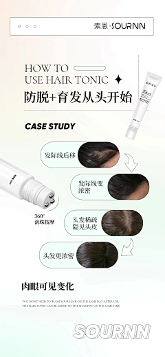 阿May1688采集到头皮管理