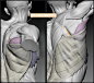 Latissimus dorsi and Erector spinae, Anatomy For Sculptors : Latissimus dorsi is a superficial muscle that covers the largest part of the back. It’s form is diverse and influenced by many factors. The picture shows how the erector spinae deep muscles infl