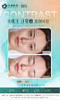 夏日感医美案例海报-素材库-sucai1.cn