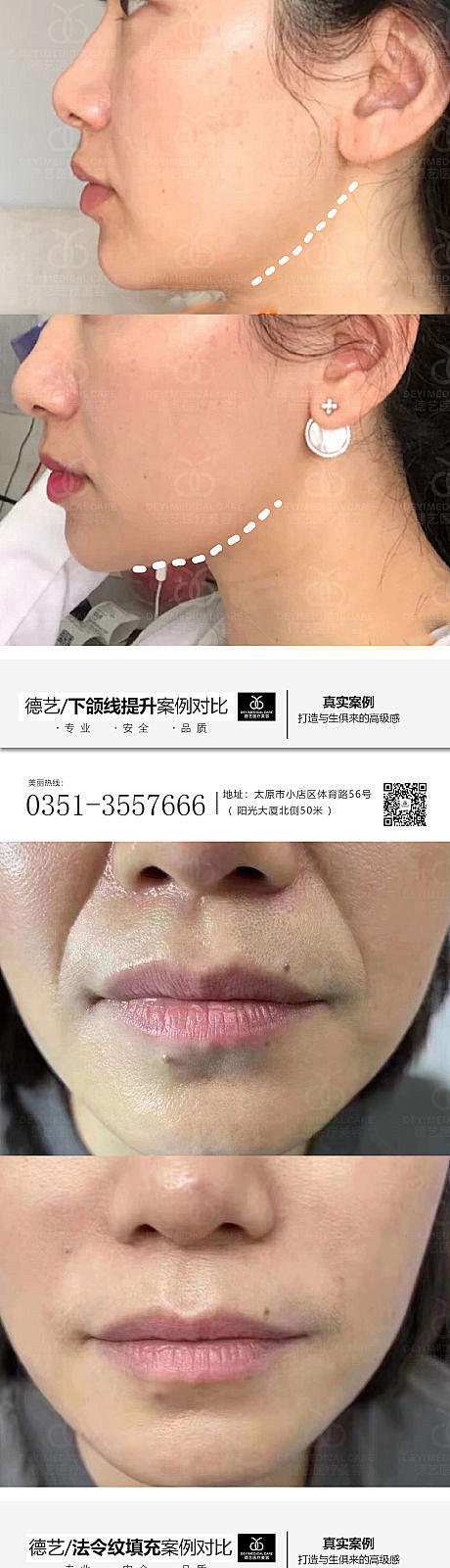 医美案例对比分享 【原图下载】微信小程序搜索@美业小行星