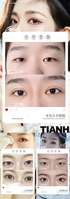源文件下载【医美整形案例宣传海报】编号：37170014914808801