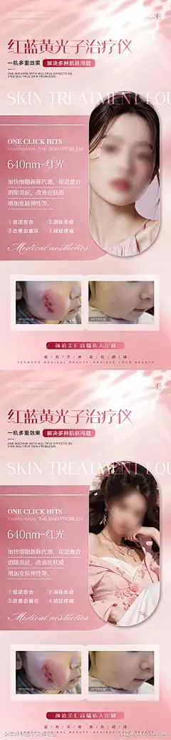 美业红蓝光案例海报_源文件下载_PSD格式_1200X5196像素-美肤,护肤,美业,对比,案例,祛痘,医美,红蓝光,海报-作品编号:2024121814109133-志设-zs9.com-源文件下载