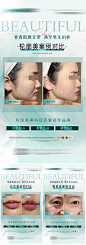 医美面部品项对比图系列-源文件分享-ywjfx.cn