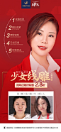线雕案例朋友圈