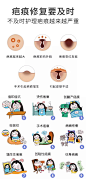 手术疤痕 痘印痘坑 剖腹产疤痕 增生性疤痕 纹身疤痕 凹陷性疤痕 妊娠纹疤痕 疤痕疙瘩 烫伤疤痕 疤痕信息流 疤痕科普着陆页 海报