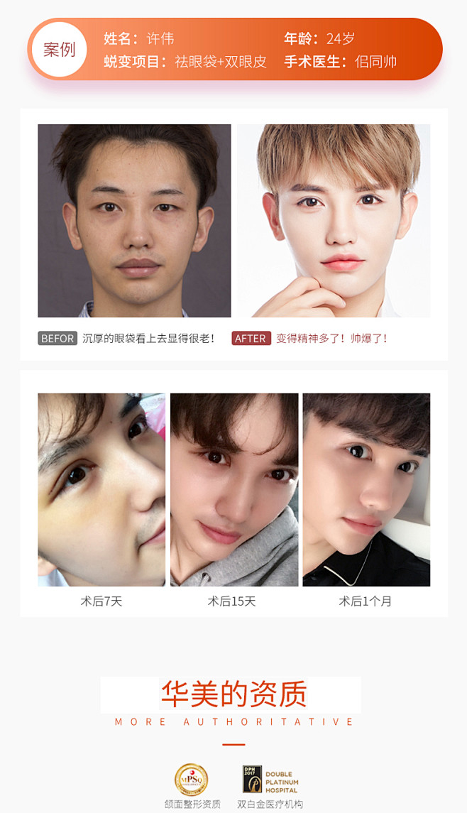 上海华美整形 祛眼袋整形手术 手术祛眼袋...