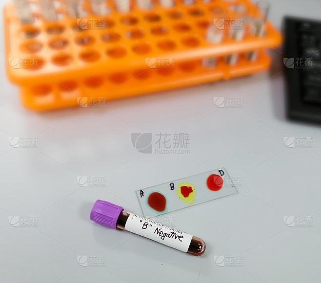 血标本分离玻片凝集法测定血型和Rh因子。血液输入。B -。有选择性的重点