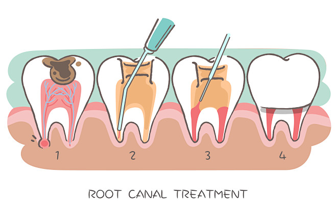 Teeth-7-035