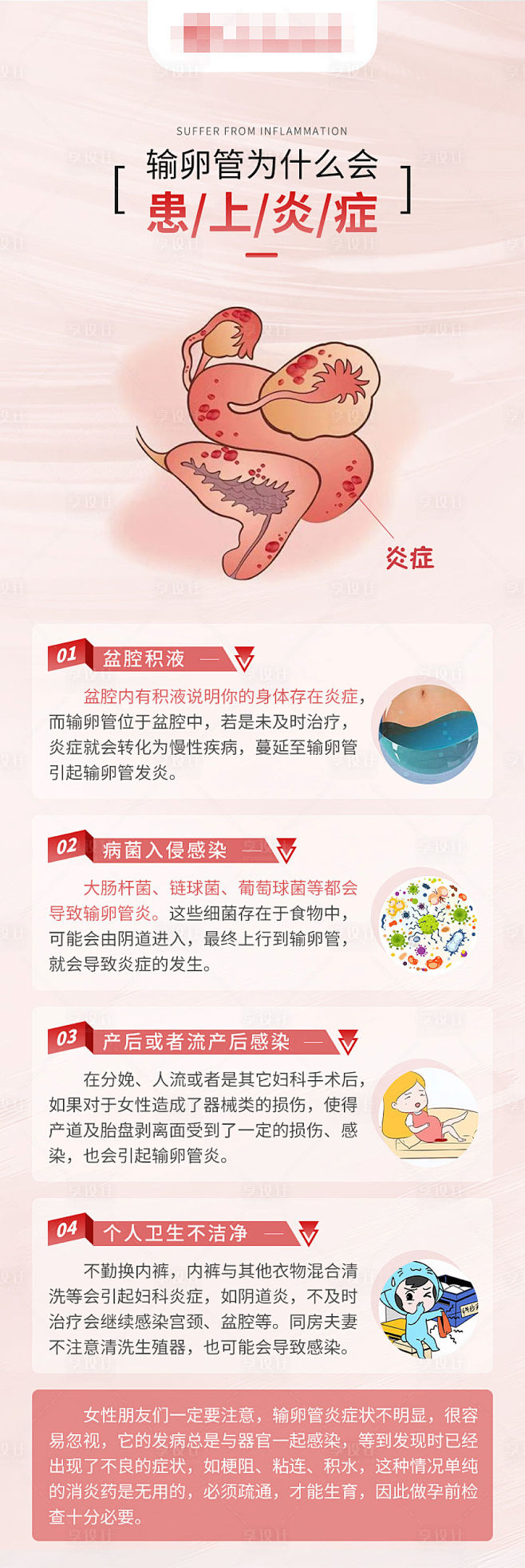 不孕科普输卵管炎症-源文件