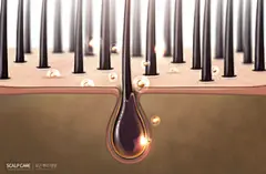 头发