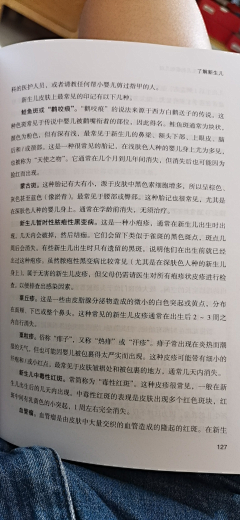 丘吉尔的黑狗采集到手机零碎知识点