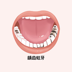 qqwqeee采集到洁牙