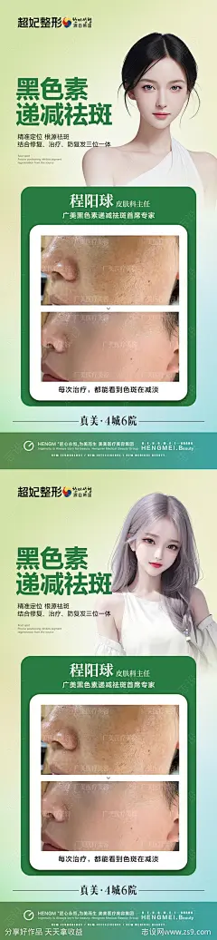 祛斑专家介绍案例海报-源文件-志设网-zs9.com