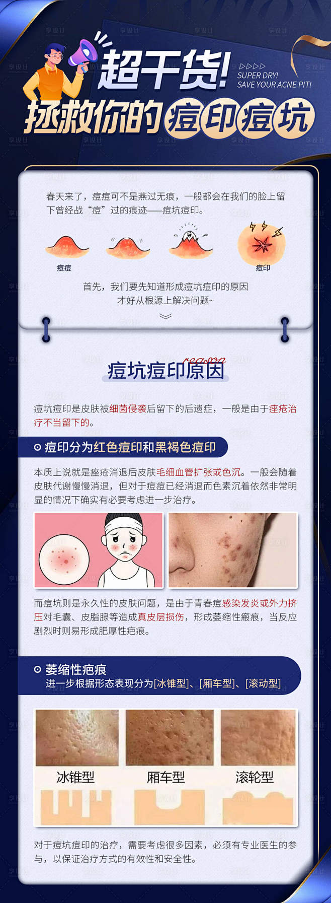 拯救你的痘印痘坑长图海报-源文件