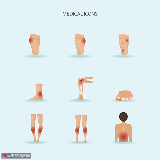 脚部皮肤骨骼感染红肿肩部医疗图标医疗保健...