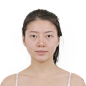 네비게이션 양악  아이디병원 구강악안면외과 : 아이디구강외과 양악수술 보험,주걱턱,안면비대칭,돌출입 양악수술 등 즉시 비용안내 가능합니다.