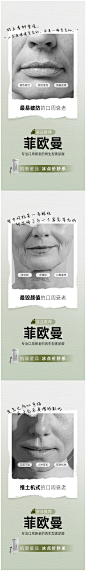 口周抗衰海报